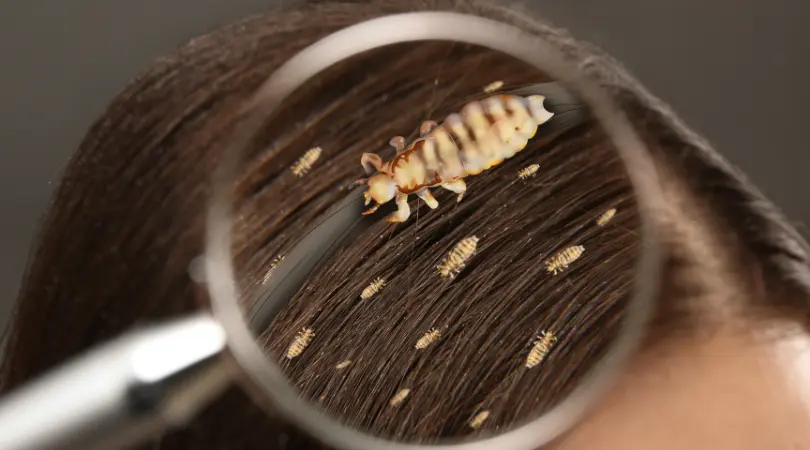 Head lice and nits